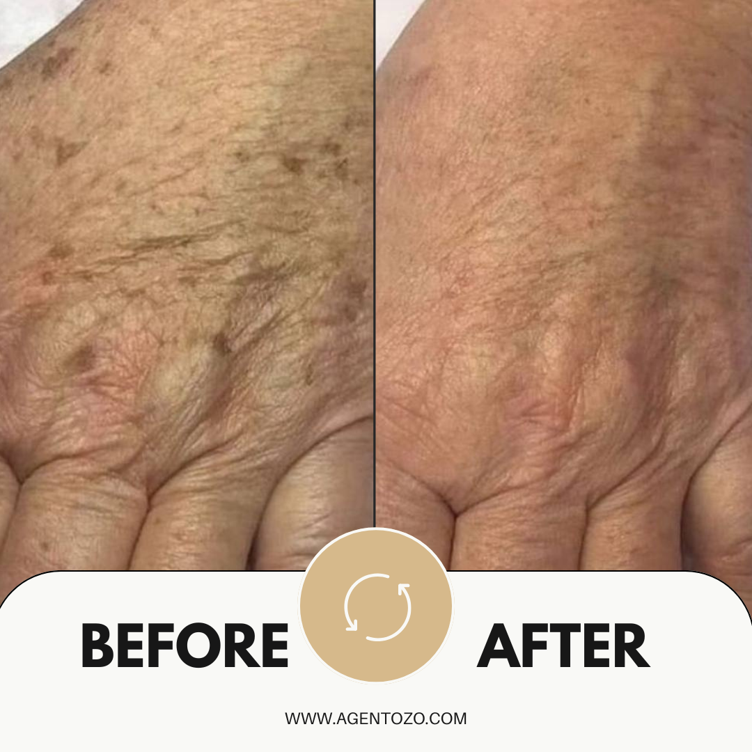 Linda F., 60